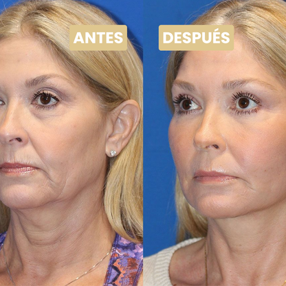 Velorie™ Sérum Natural Colágeno y Péptidos